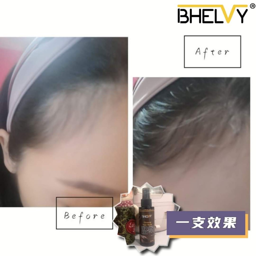 Bhevly Ginseng Hair Tonic Shopee Malaysia