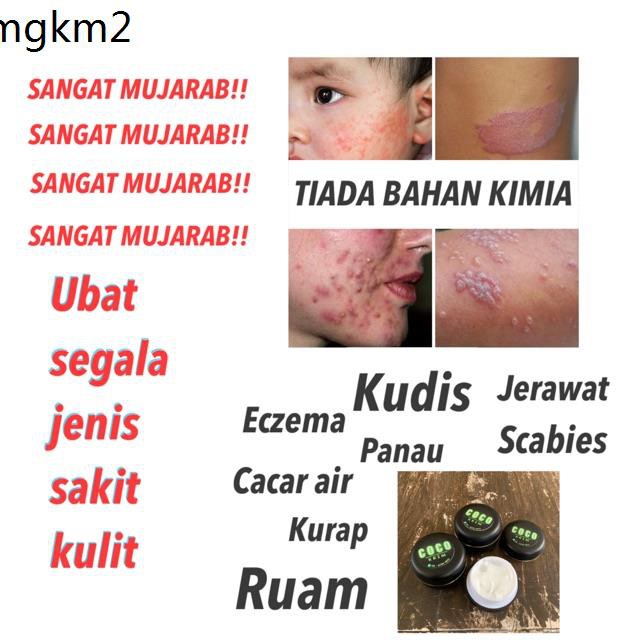 Kacang Badam Badam Cincang Badam Hiris Mujarab Ubat Gatal Ekzema Kurap Scabies Ruam Susu Jerawat Cacar Air Pana Shopee Malaysia