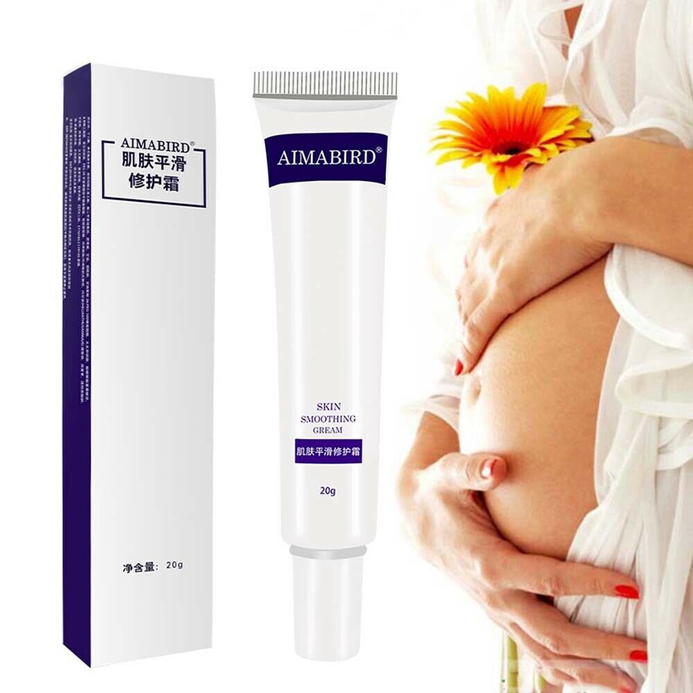 best old stretch mark removal cream