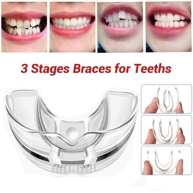 3Pcs/ Set Dental Tooth Orthodontic Appliance Trainer Dental Braces