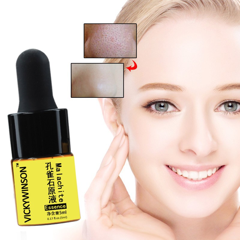 Natural Malachite toner face serum extract essence skin Detox Whitening ...