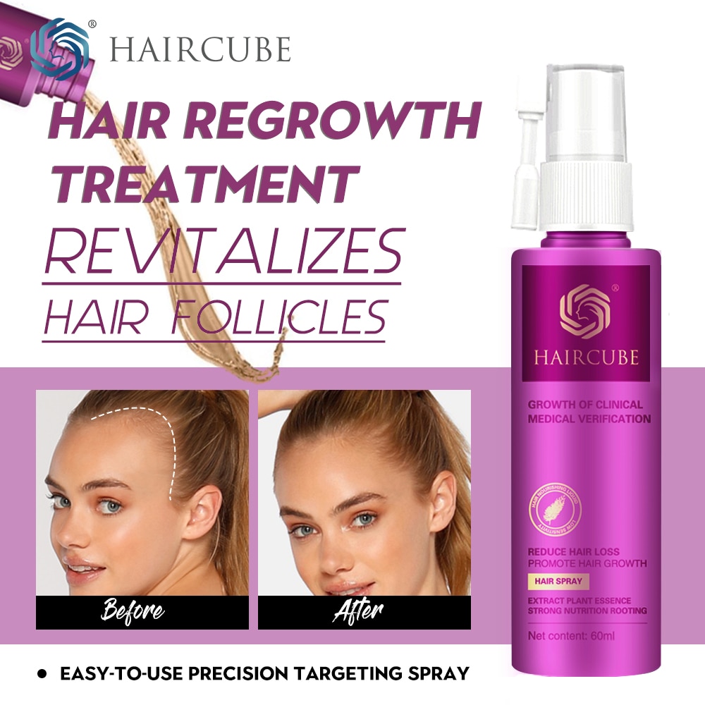 Fast Hair Growth Serum Spray 60ml Anti Hair Loss Treatment Dense Thicken  Hair Nourish Hair Roots Hair Care Products Wome | Shopee Malaysia