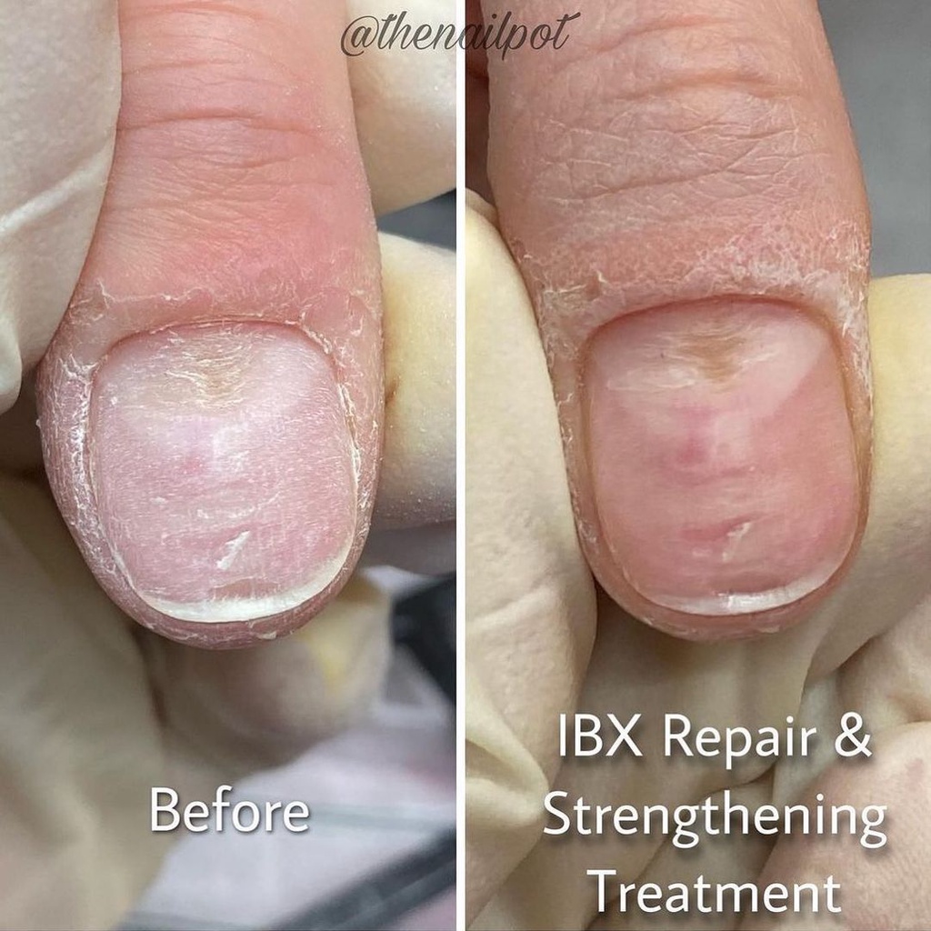 IBX SYSTEM Nail Treatment [Ready Stock] | Shopee Malaysia