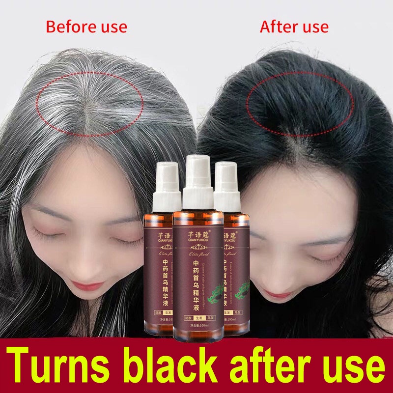 Black Hair Serum Dyeing Spray Black Hair Growth Shampoo 100ml Polygonum  Multiflorum Natural White Hair To Black Promote hair growth | Shopee  Malaysia