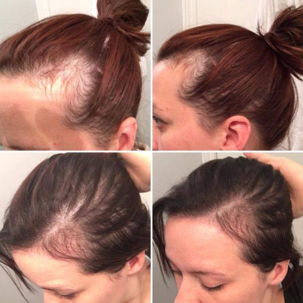 IMON Anti Hair Loss Shampoo (1000ml)Hair Growth Moisture Kerantin Scalp  Treatment Rambut Restore Anti Hair Loss Tonic | Shopee Malaysia