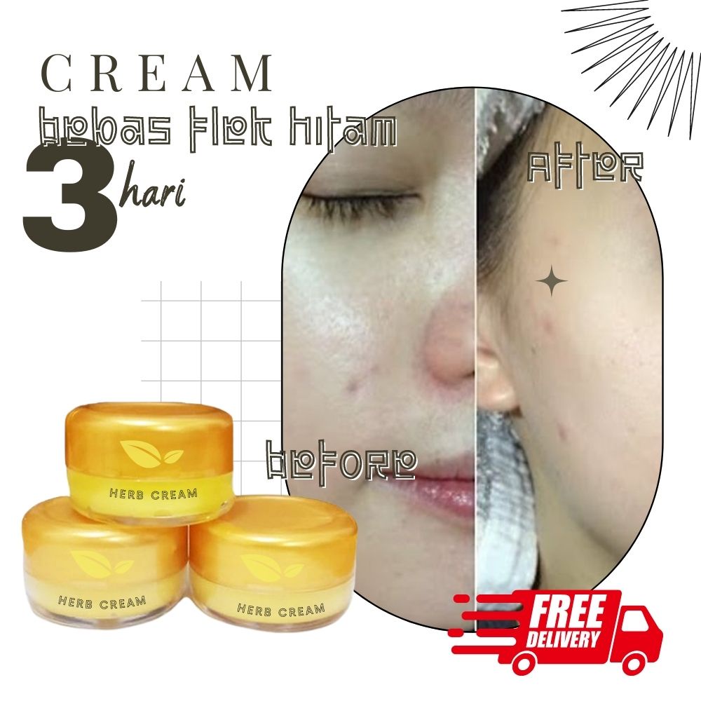 Black Spots Ointment 100 Original Steamer Spots Cream Serum Cream