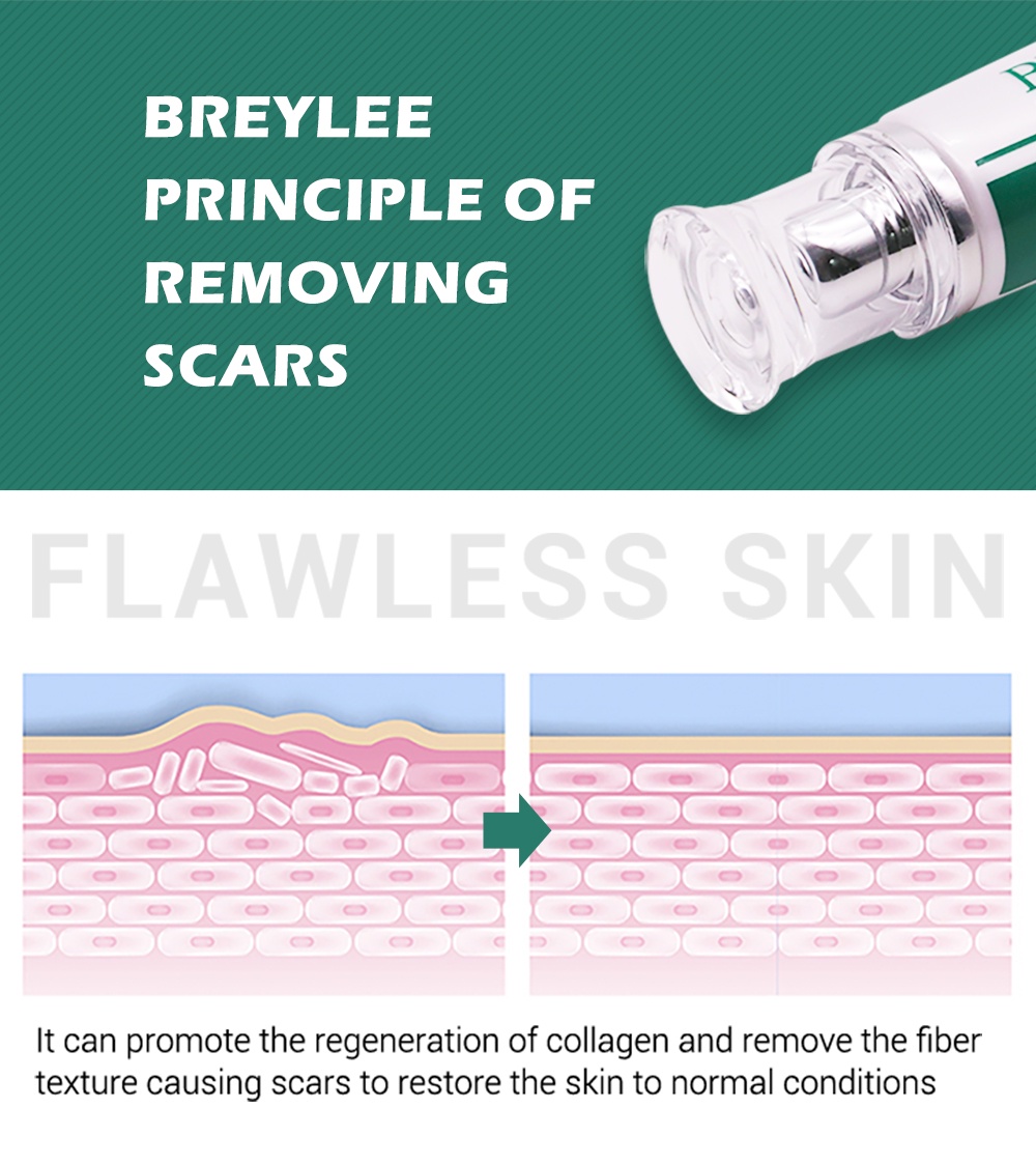 BREYLEE Scar Removal Cream Treatment Remove Stretch Marks Whitening Cream (30g) Shopee Malaysia