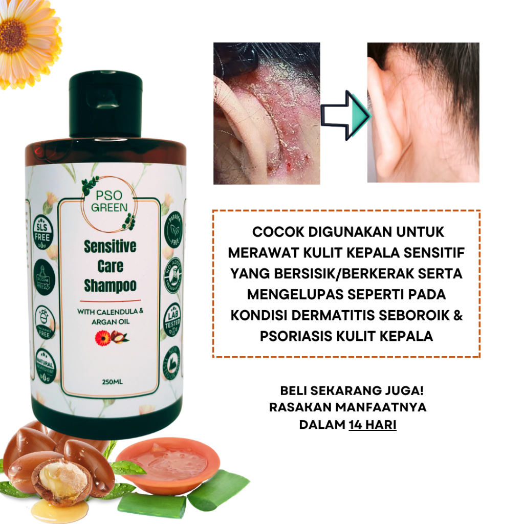Psogreen Argan & Calendula Shampoo - Sensitive, itchy, dandruff, psoriasis, dermatitis seborrheic, non sls non perfume
