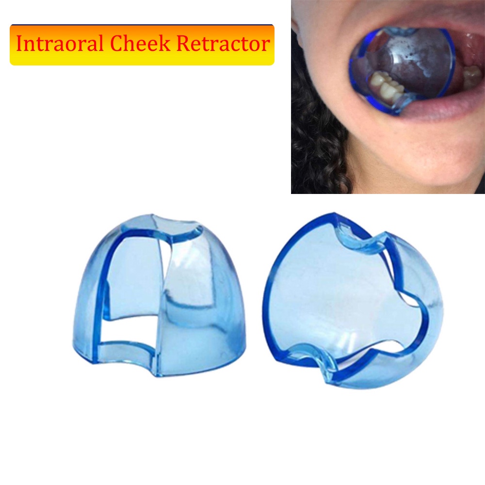 Anterior Posterior Teeth Opening Device Orthodontic Cheek Retractor Expander Dental Accessories Oral Care