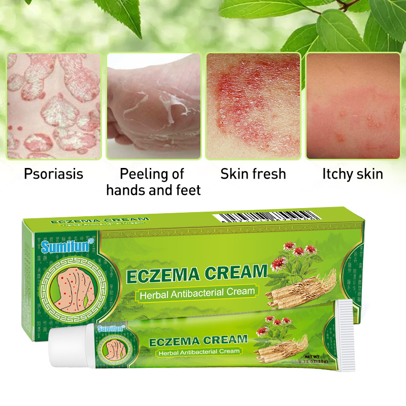 Ubat Gatal Kurap Cina Berkesan Mujarab Eczema Cream Psoriasis