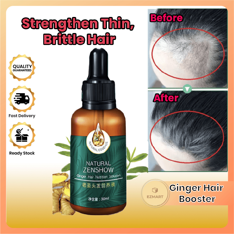 Phytopolleine Botanical Scalp Treatment - Prices and Promotions - Mar 2023  | Shopee Malaysia