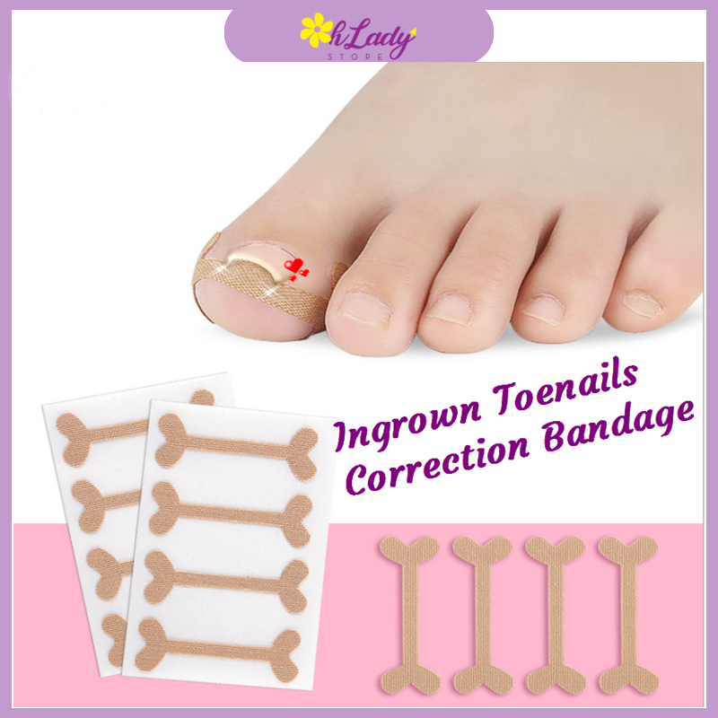 Ingrown Toenails Band Aid Relief Pain Paronychia Correction Pedicure Elastic Force Sticker (021)