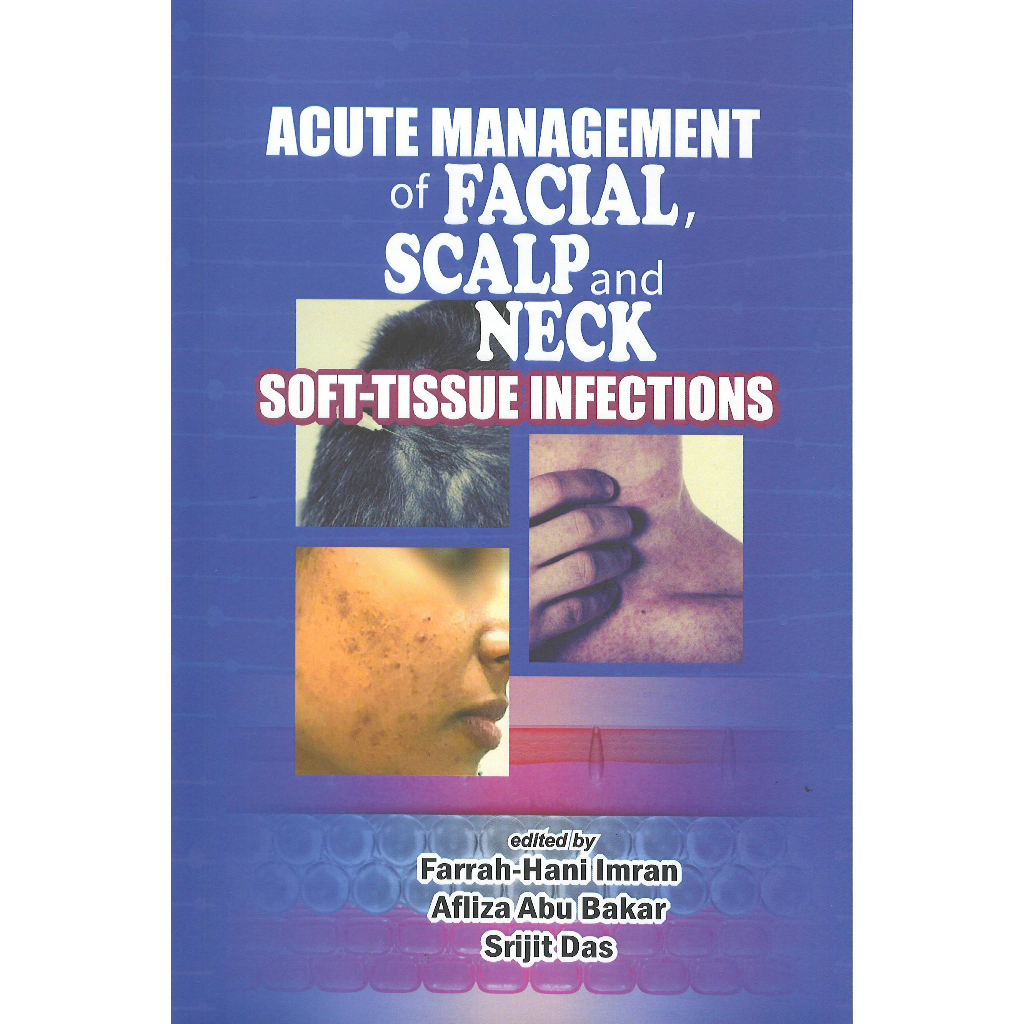 Acute Management of Facial, Scalp and Neck SoftTissue Infections