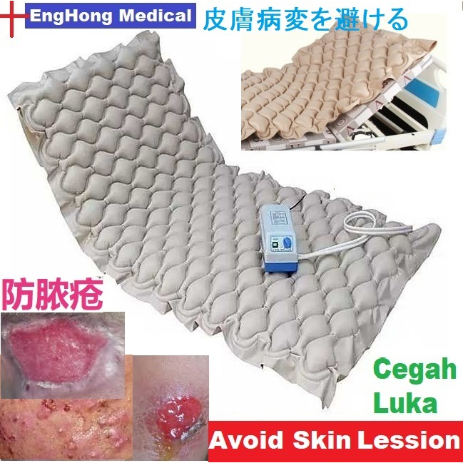 EngHong Ripple Mattress Air Mattress Hospital bed, Medical Bed, Avoid Lession, Avoid Skin Injury, Mencegah Luka Badan