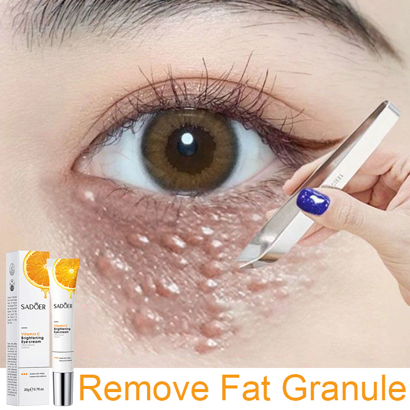 vitamin c eye cream dark circle eye bag remover eye serum anti aging moisturizer fat particles Remove Fat Particles眼霜20g