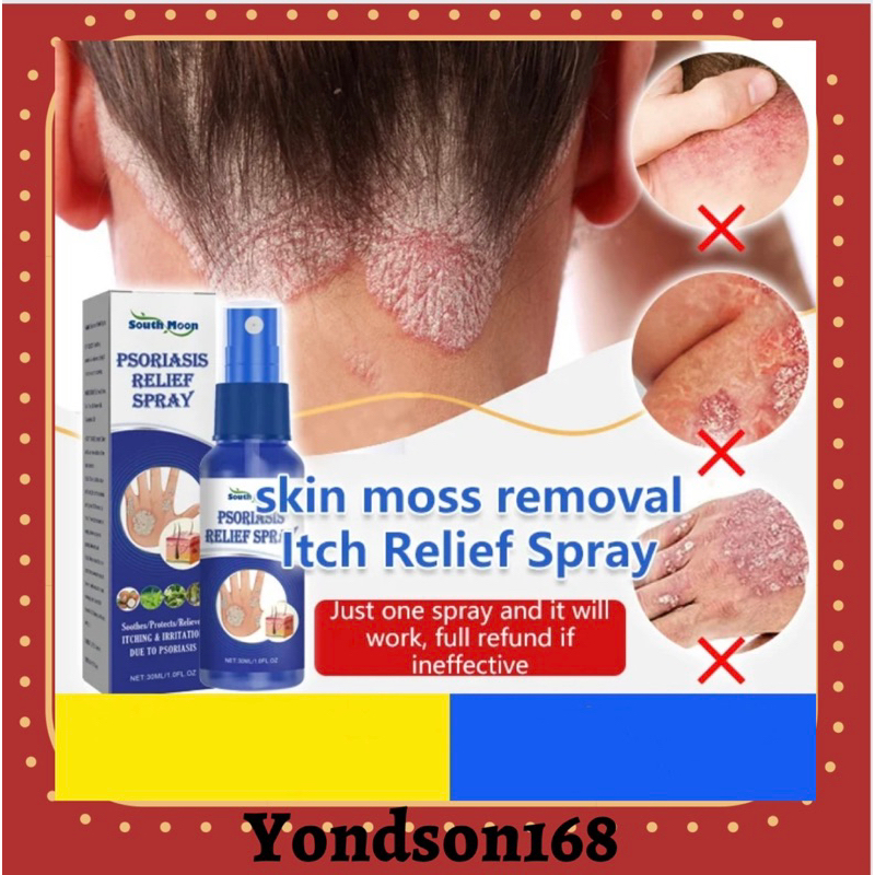 SouthMoon Psoriasis Relief Skin Psoriasis Spray Eczema Spray Relief spray Anti Fungal Skin Infections Spray牛皮藓舒缓喷雾