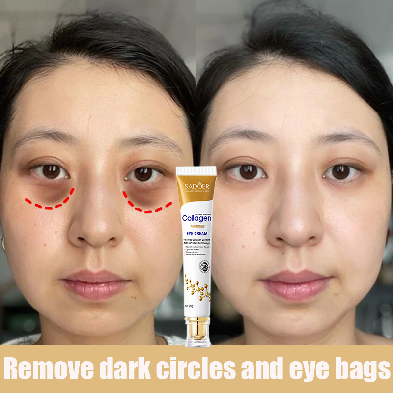 Krim Mata Eye Cream Hilangkan Mata panda Dark circles Eyebag Anti aging Puffiness Anti-wrinkle moisturizer fat particles