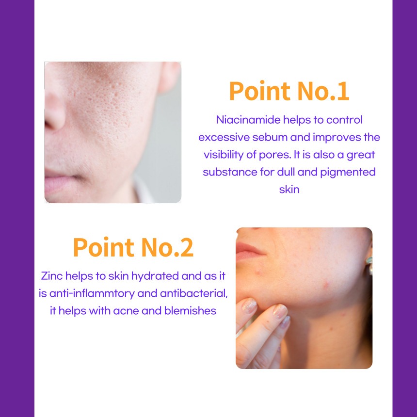 ✨TO Niacinamide 10% + Zinc 1% ✨(30/60ml)✨ DECIEM✨