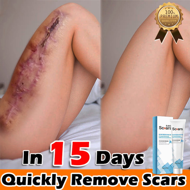 scar removal gel scar repair cream stretch marks remover fade burn scars scald acne marks waterproof for pregnant 20g