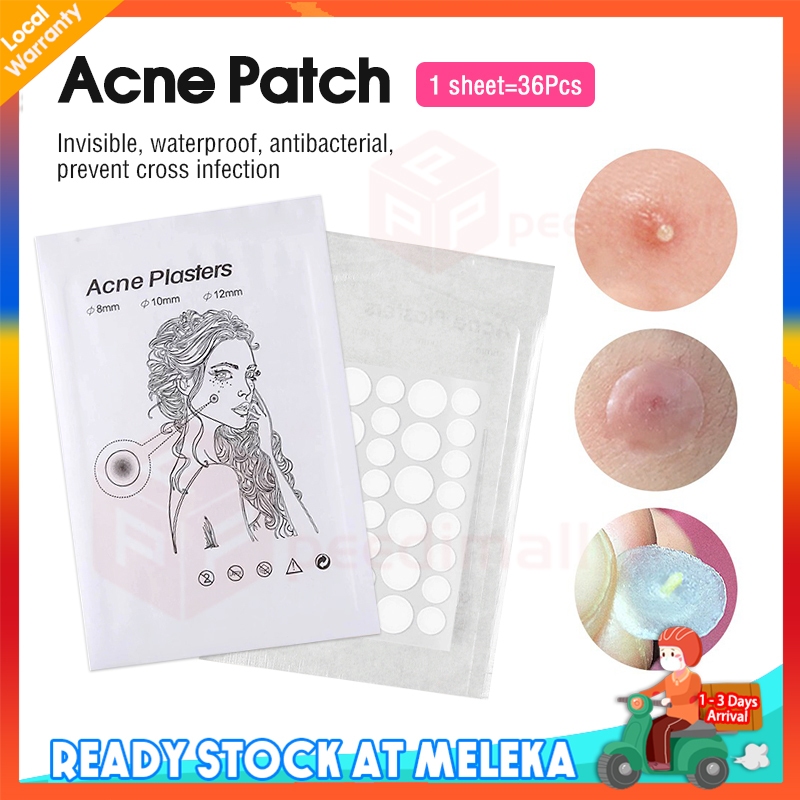 36Pcs Acne Pimple Removal Patch Acne Treatment Stickers Pimple Remover Sheet Mask Skin Care Hydrocolloid Stickers