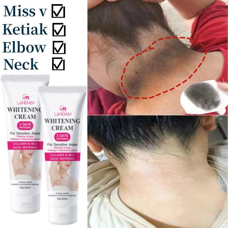 pemutih ketiak dan celah peha krim pemutih Brightening Cream armpit buttocks private parts elbow neck nipple whitening