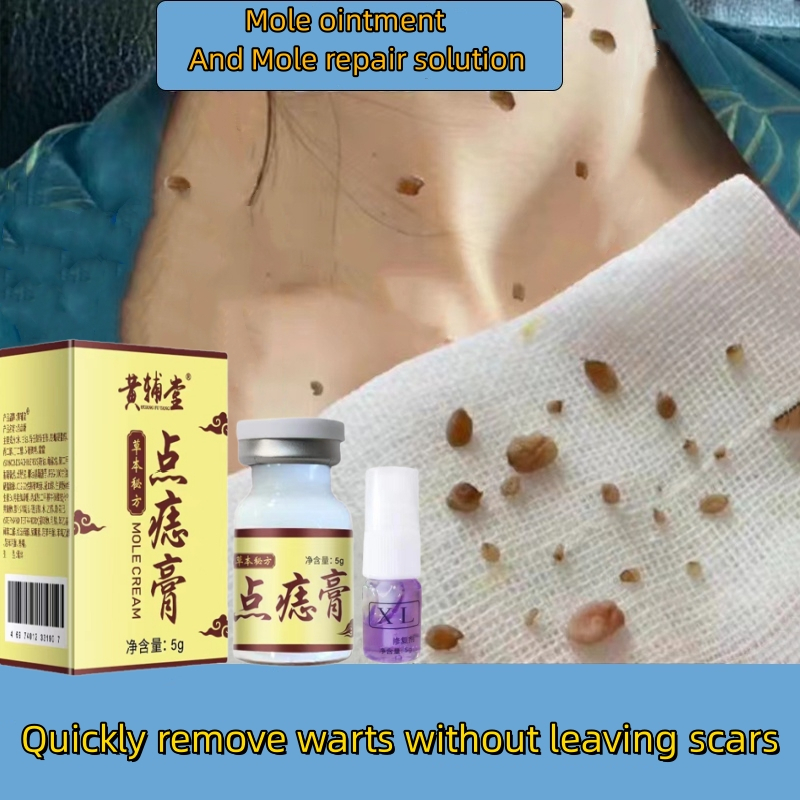 ubat kutil tahi lalat ketuat dan biji kolesterol Warts removal cream Skin tag removal Mole remover cream 点痣膏