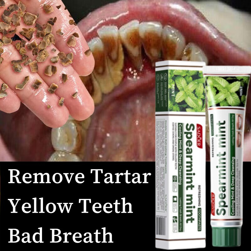 Mint Antibacterial Teeth whitening toothpaste whitening pen mouth spray tartar remover Yellow Teeth Removal 美白牙贴