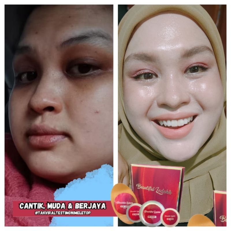 BEAUTIFULLEDEH NEW PACKAGING(WHITE BOX)WITH FREE GIFT