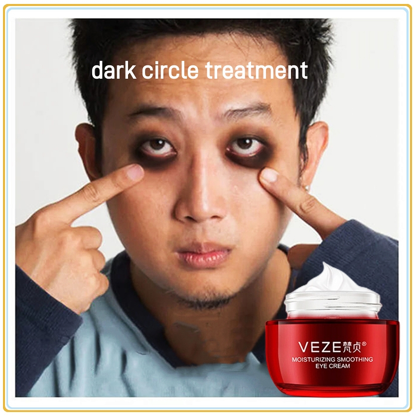 eye cream dark circle treatment Krim mata eye bag remover eye care anti aging anti wrinkle fat granule removal 眼霜 30g