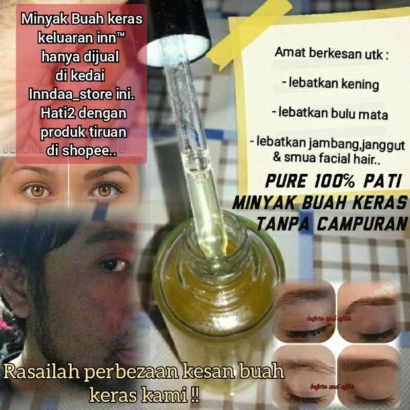 Minyak Buah Keras 100%pure utk Lebat Kening,Rambut,Jambang,Janggut 10ML