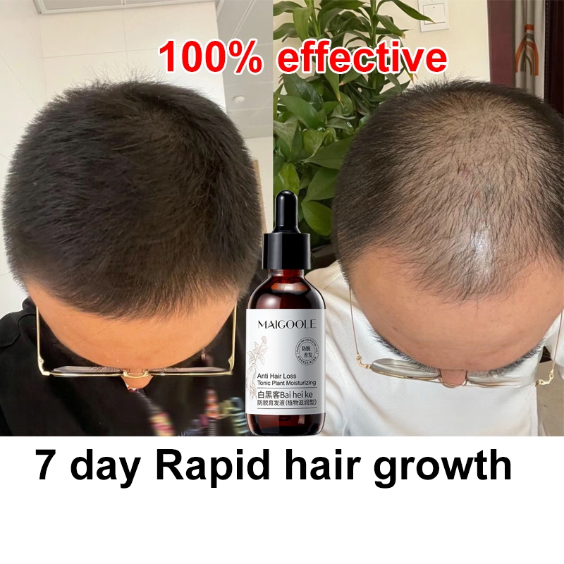 Hair Growth Serum Hair serum Hair tonic Plant Essence Natural Hair Loss Herbal Anti Hair Loss Promote Hair Growth