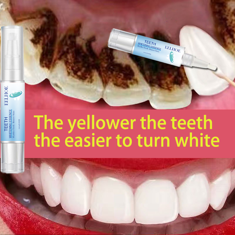 Teeth Whitening Pen teeth Whitening Gel Pen Remove Stains Tooth Cleaning Tool Whitener Teeth Whitening Oral Hygiene Pen