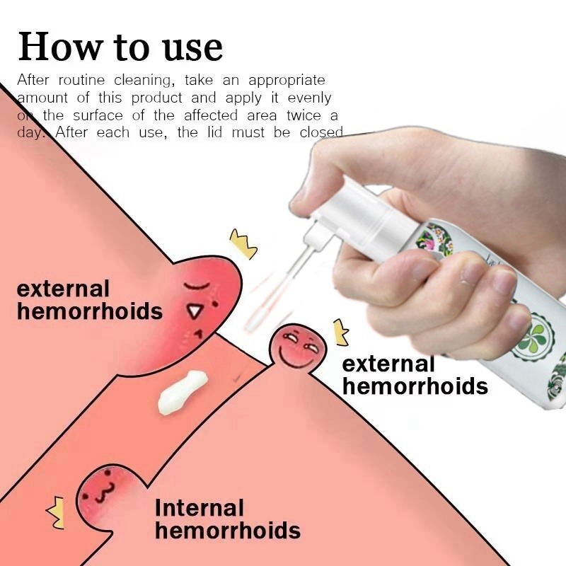 Hemorrhoids Spray ubat buasir 100% berkesan Powerful Hemorrhoids Treatment Pain Relief External Fissure 草本配方30ml 痔疮喷雾止痛