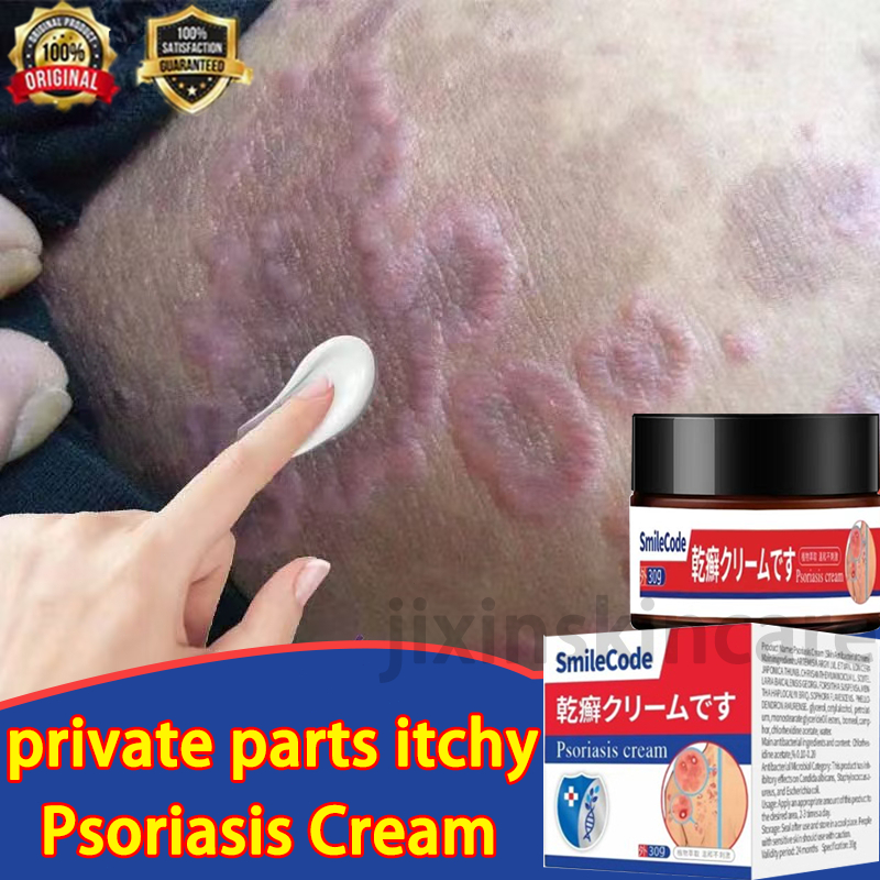 [100%effective]eczema psoriasis cream krim gatal kulit 30G Herbal antibacterial Anti itch Relief Eczema Cream Antifungal