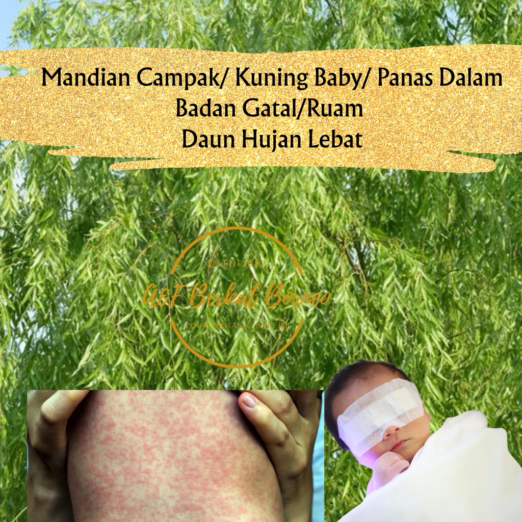 DAUN HUJAN LEBAT /MANDIAN CAMPAK/ JAUNDICE BABY/ RUAM/GATAL KULIT
