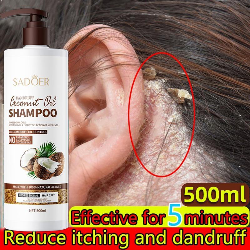 Sadoer Coconut Oil Shampoo Anti-Dandruff Refreshing Oil Control Deep Scalp Removal Mite…