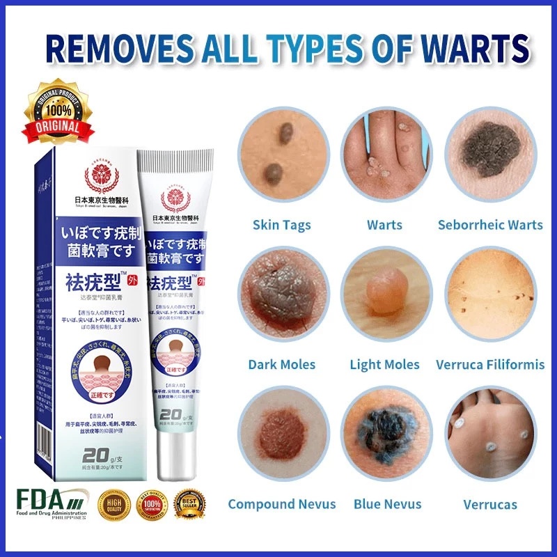 Warts removal cream ubat kutil buang tahi lalat dan biji kolestrol Skin Tag Remover Mole repellent painless effective