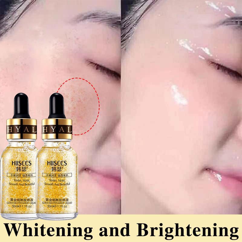50ml Whitening and freckle removing essence Whitening Face Serum Yellowish Brown Spots,Freckles,Senile Spots,Black Spots