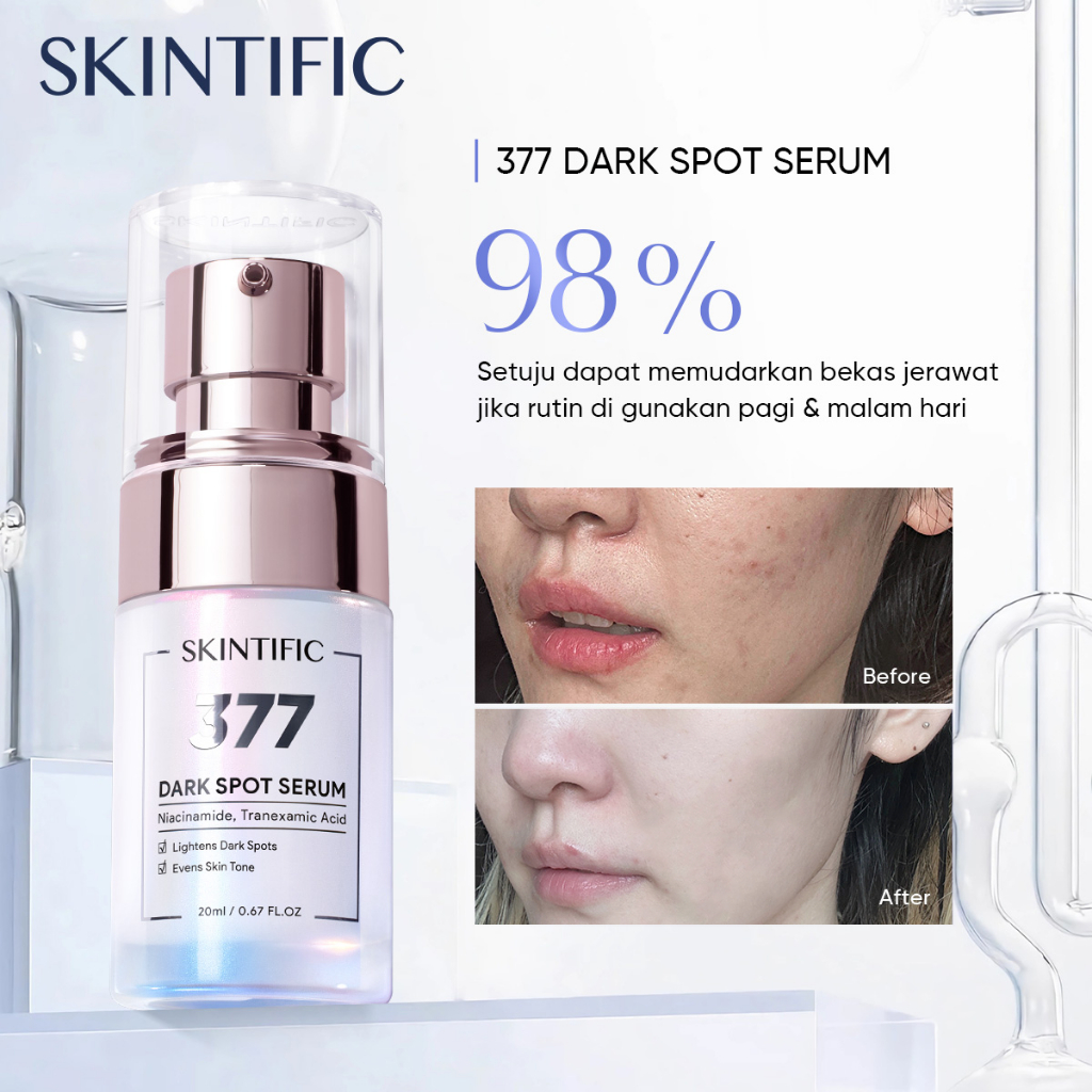 SKINTIFIC SymWhite 377 Serum Muka Fade Dark Spot in 14 days Essence with Niacinamide Brightening Whitening Skincare