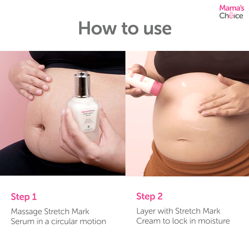 Mama's Choice Stretch Mark Treatment Series | Stretch Mark Cream + Serum (Safe, Halal, Natural Maternity Skincare)
