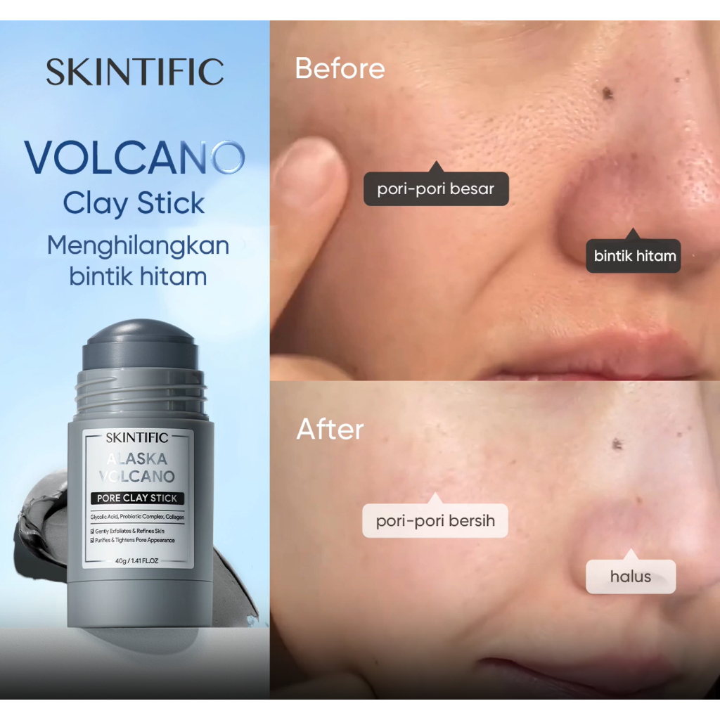 [100% Ori] SKINTIFIC Alaska Volcano Clay Deep Pores Cleansing Clay Mask Stick Reduce Blackheads Acne Calming For Oilness