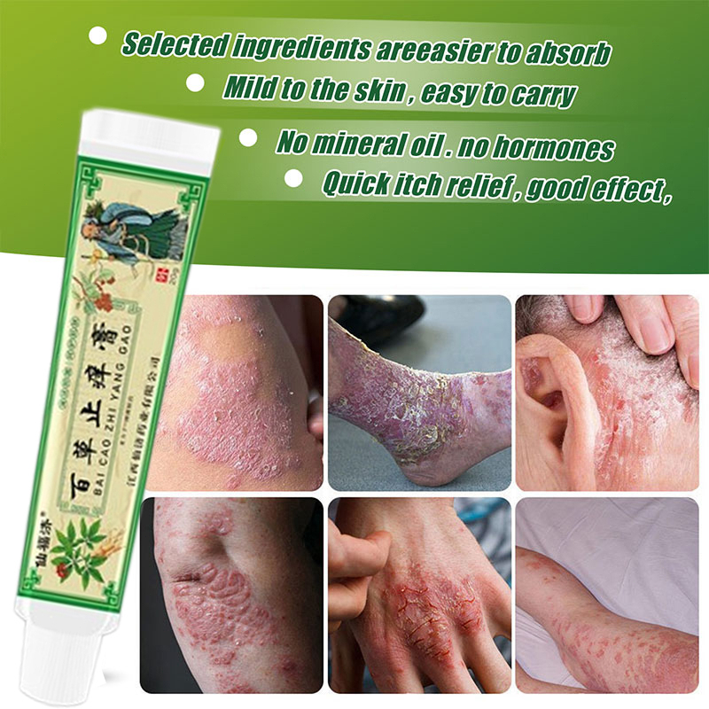 krim gatal kulit eczema cream psoriasis cream Herbal antibacterial Anti itch Relief Eczema Cream Antifungal 30g 濕疹止癢膏
