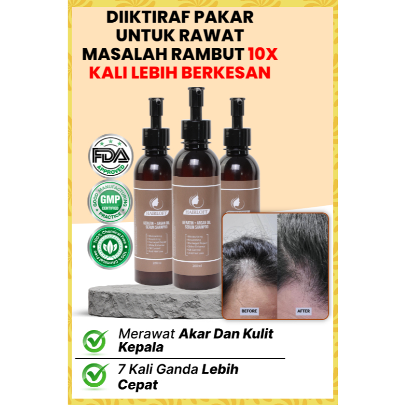 HairLoft Hair Serum: Diiktiraf Pakar untuk Rawat Masalah Rambut – 10X Lebih Berkesan