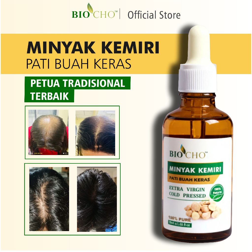 BIOCHO - MINYAK BUAH KERAS, MINYAK KEMIRI HAIR OIL UNTUK RAMBUT GUGUR 100% NATURAL, SESUAI SEMUA PERINGKAT UMUR