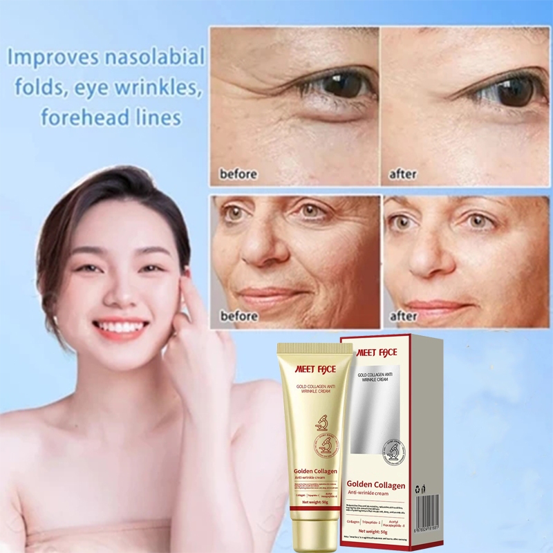 【Tightens, Lightens Wrinkles】Anti Wrinkle Cream Gold Collagen Anti-wrinkle Cream Highly Effective Relieve Dry Line蛋白抗皱霜