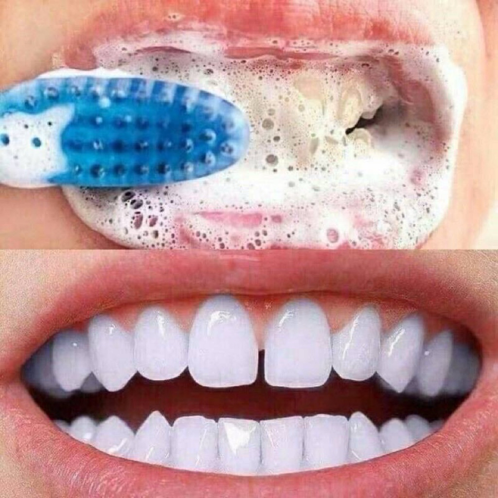 UBAT GIGI BAKING SODA GIGI PUTIH bersihkan Kerak hilangkan Bau mulut putihkan gigi pemutih gigi teeth whitening gel