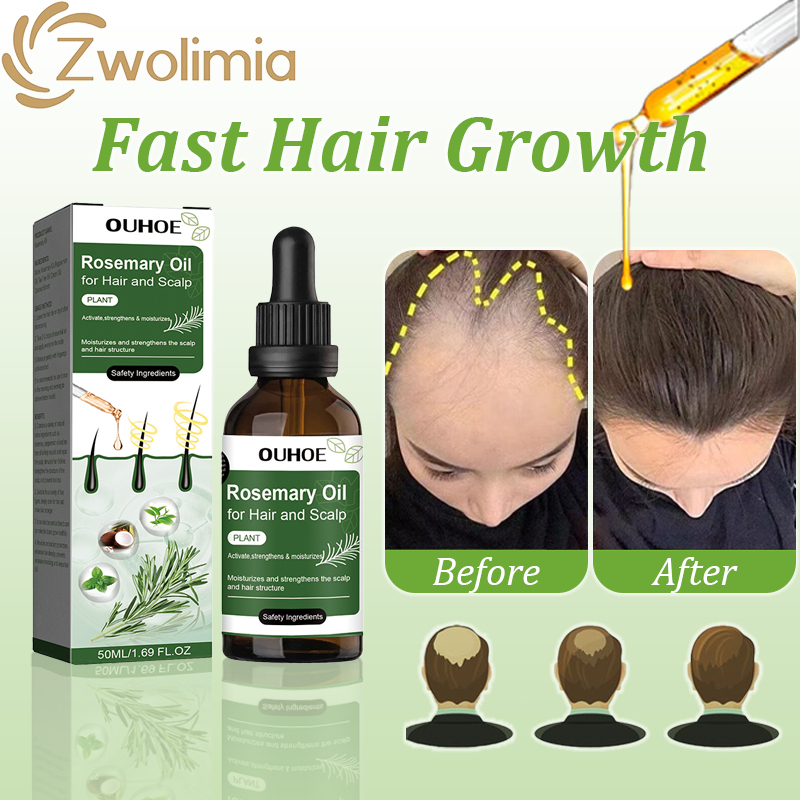 Zwolimia Minyak Lebatkan Rambut Rosemary Oil For Hair Growth Serum Rambut Gugur Anti Hair Loss Treatment Tonic Hair 生發水