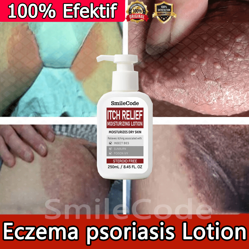 Psoriasis Eczema 250ML Antifungal cream Eczema cream gatal kulit krim gatal kulit herba cina Ubat gatal STEROID FREE止痒乳液