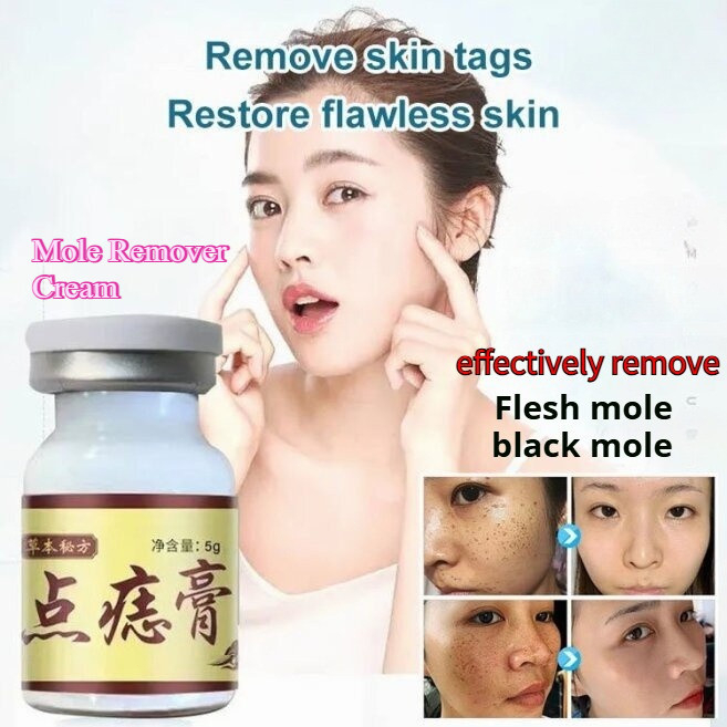 5g Mole dropping Cream No Mark Remove Eugene Moles Flat Meat Thorn freckles Granules Fat G/Mole Remover Cream 點痣膏