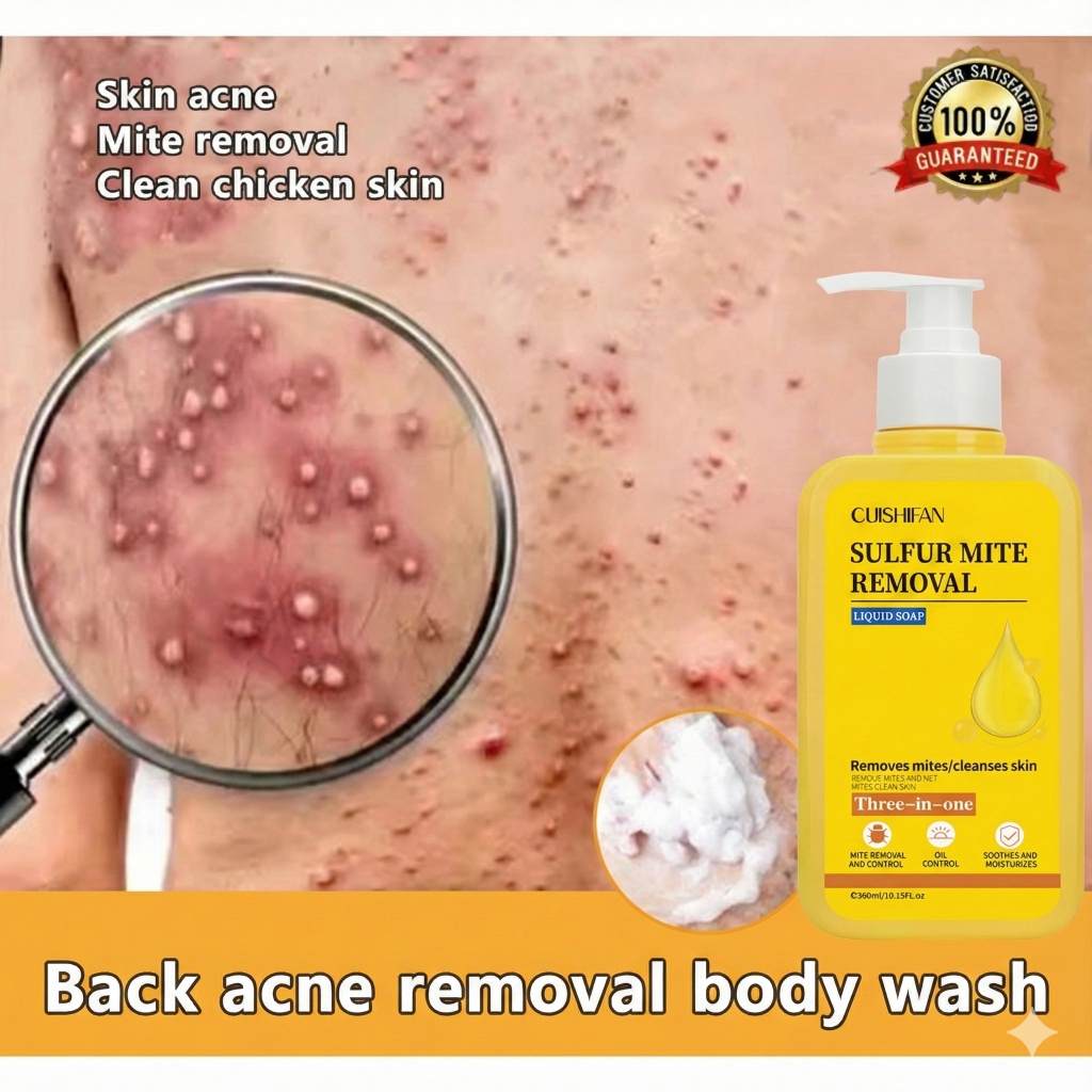 CUISHIFAN Sabun Sulfur 3-in-1(Lelaki & Wanita) Atasi Jerawat Badan, Kurap & Kulit Kering!